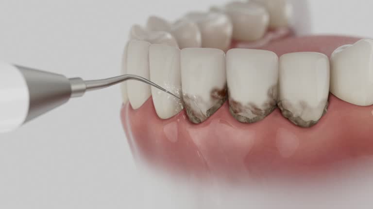 Reliable Teeth Cleaning And Checkup contractor in Kalamazoo County County, MI by Dentist Open Now